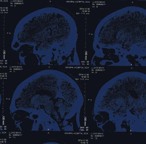 Nightingales - Mind Over Matter in the group CD / Rock at Bengans Skivbutik AB (1318416)