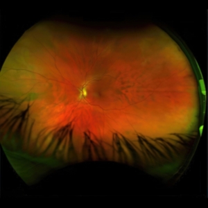 Puciato Greg - Mirrorcell (Black & Grey Splatter) in the group VINYL / Hårdrock at Bengans Skivbutik AB (4186173)