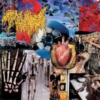 Trichomoniasis - Harvest Of The Killing Fields